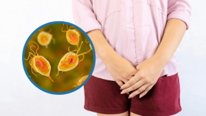 vaginitis - kolpitida- Κολπίτιδα