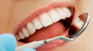 Πώς να μην χάσετε τα δόντια σας εξαιτίας της περιοδοντίτιδας