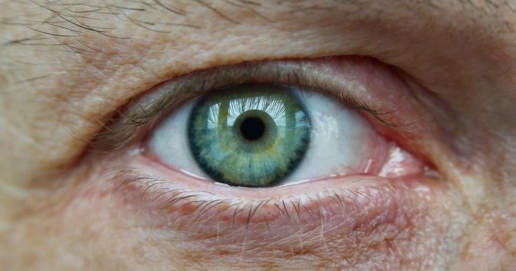 μυγάκια στα μάτια